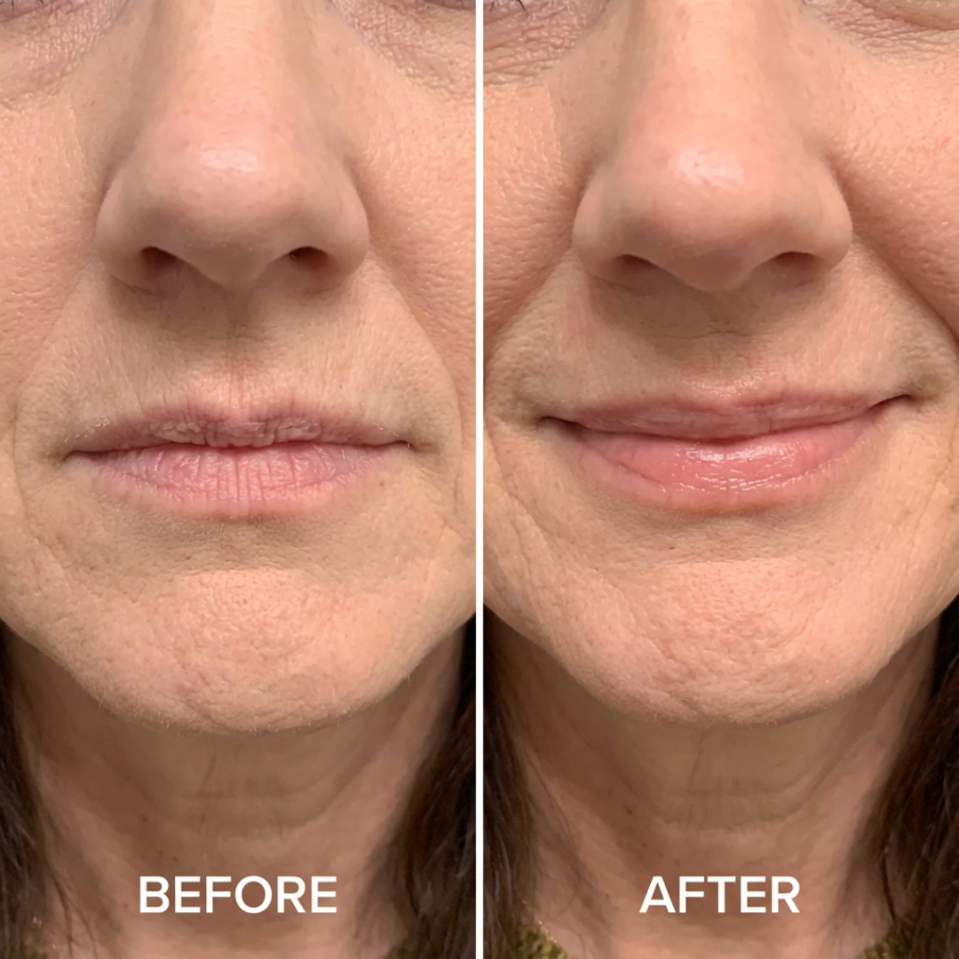 Peptide Lip Gloss