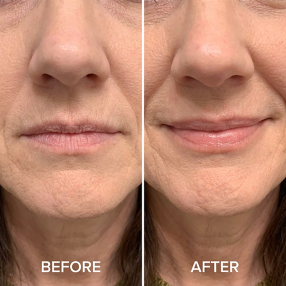 Peptide Lip Gloss